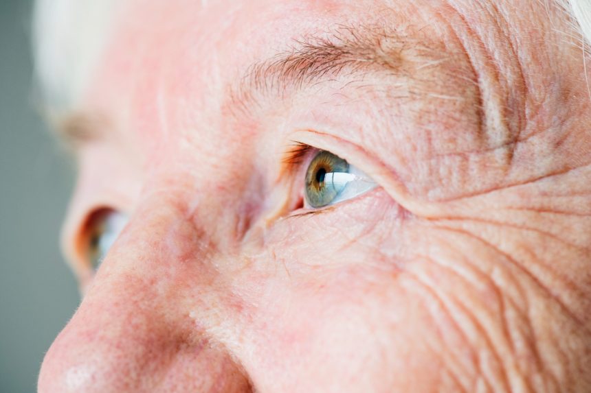 Verão à vista: saiba como cuidar da saúde dos olhos na temporada de férias